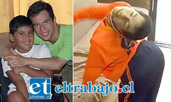ANTES Y DESPUÉS.- A la derecha vemos cómo estaba Maximiliano hace unas semanas, a la izquierda ya le vemos al lado de Nicolás, dándole apoyo tras la instalación de su dispositivo.