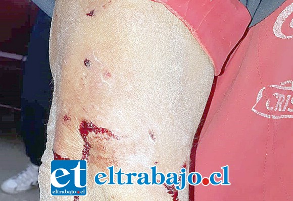 Así quedó el brazo del denunciante, él asegura que fue mordido por un perro de la insigne institución policial.