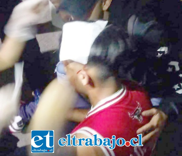 Un joven de 18 años de edad resultó con lesiones graves tras el impacto de perdigones en su cabeza. (Fotografía: Radio Preludio).