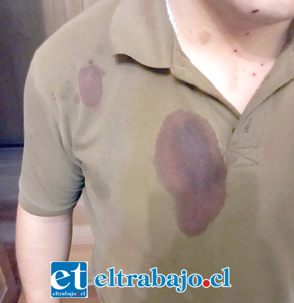Dos funcionarios policiales resultaron heridos por el impacto de perdigones en Llay Llay.