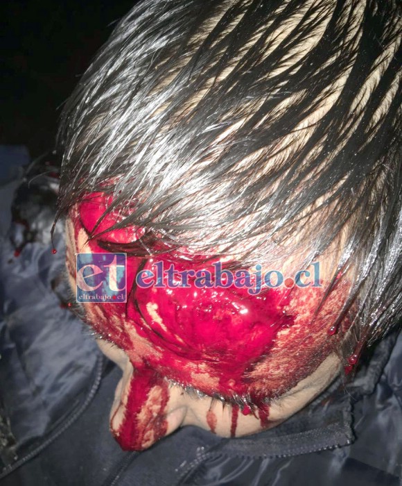 Un enorme corte de unos 15 centímetros en la frente le provocaron los delincuentes a la víctima.