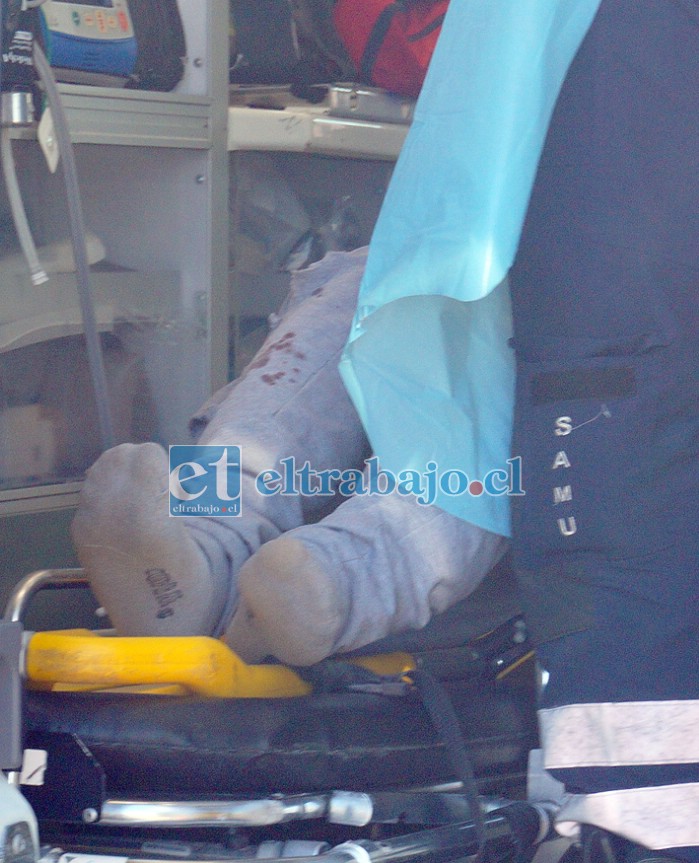 MUY MAL HERIDO.- Las cámaras de Diario El Trabajo captan el pantalón ensangrentado del motociclista mientras era atendido por personal del SAMU.